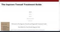 Ingrown Toenail Treatment Guide