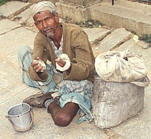 A patient of Leprosy