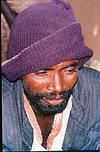 Leper beggar, from Yeshwantapur