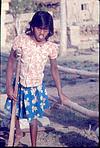 A disabled girl in Surendra koulgis ashram, Melukote