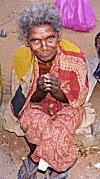 A Patient of Leprosy Begging outside a Church