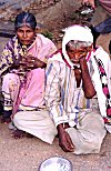 Picture of a Patient of Leprosy