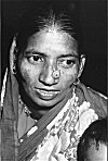 Pierced Nose of a Daldi Woman